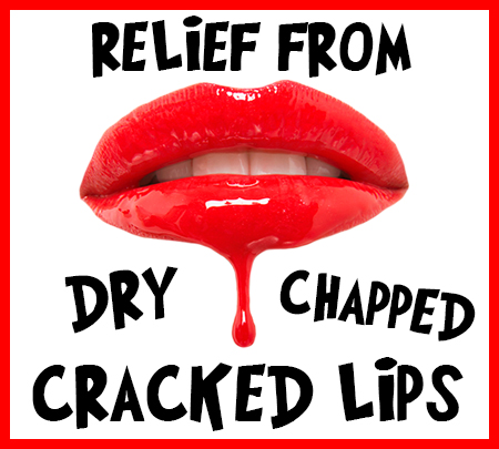 Cracked_Lips
