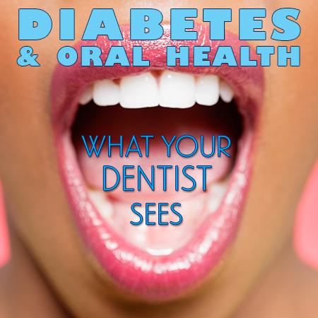 dental_and_diabetes